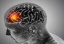 Estudo acende alerta para meningite: queda nas mortes é lenta e pode comprometer meta da OMS
