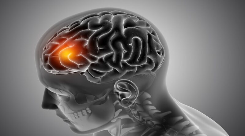 Estudo acende alerta para meningite: queda nas mortes é lenta e pode comprometer meta da OMS